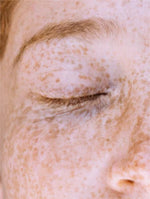 Sérum s vitaminem C