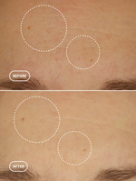 Pleťové sérum – alternativa retinolu